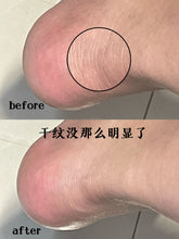 Load image into Gallery viewer, [日本] 小林制药润足膏
