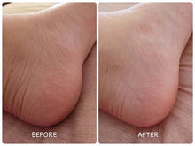 Load image into Gallery viewer, [日本] Baby Foot 脚膜
