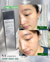 Load image into Gallery viewer, [韩国Daiso] VT 微针精华
