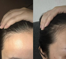 Load image into Gallery viewer, [韩国] Vive Lab 生发精华
