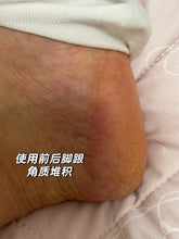 Load image into Gallery viewer, [日本] Nature Conc 足部薬用邦理
