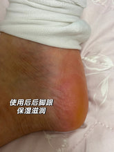 Load image into Gallery viewer, [日本] Nature Conc 足部薬用邦理
