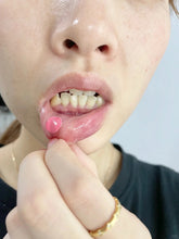 Load image into Gallery viewer, [日本] Taisho 大正口内炎溃疡贴
