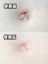 Load image into Gallery viewer, [日本] Spot Jelly 肚脐清洁贴
