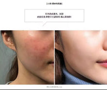 Load image into Gallery viewer, [现货] Somebymi 30天奇迹洗面奶
