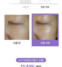 Load image into Gallery viewer, [韩国] Biodance 水凝胶眼膜
