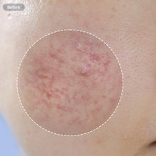 Load image into Gallery viewer, [韩国] Anua 鱼腥草洗面奶
