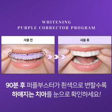 Load image into Gallery viewer, [韩国] Euthymol 美白牙贴
