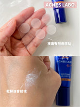 Load image into Gallery viewer, [日本] Acnes Labo	祛痘膏
