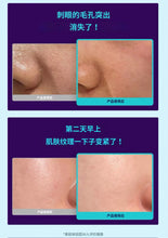 Load image into Gallery viewer, [韩国] Dr.G 毛孔紧致棉片
