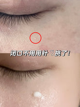 Load image into Gallery viewer, [韩国药房] Dr.Deep 局部焕肤点点霜
