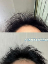 Load image into Gallery viewer, [韩国药房] Minoxidil 米诺地尔生发液
