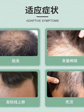Load image into Gallery viewer, [韩国药房] Minoxidil 米诺地尔生发液
