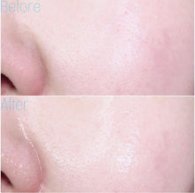 Load image into Gallery viewer, [韩国] Mediheal 面膜
