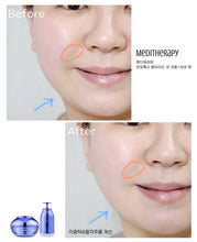 Load image into Gallery viewer, [韩国] Meditherapy V脸紧致按摩面霜+美容仪
