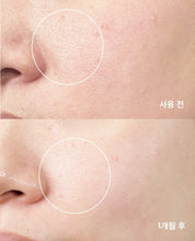 Load image into Gallery viewer, [韩国] Meditherapy 毛孔藻针精华 + 美容仪
