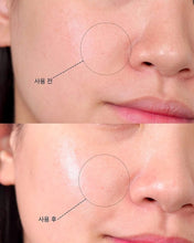 Load image into Gallery viewer, [韩国] Meditherapy 毛孔藻针精华 + 美容仪

