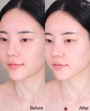 Load image into Gallery viewer, [韩国] Meditherapy 美白贴膜
