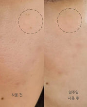 Load image into Gallery viewer, [韩国] Meditherapy 美白贴膜
