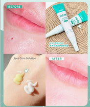Load image into Gallery viewer, [韩国Daiso] CNP Bye od-td 祛痘膏
