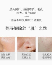 Load image into Gallery viewer, [韩国] Hexkin 清洁白泥
