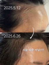 Load image into Gallery viewer, [韩国] Refilled 头皮生发精华
