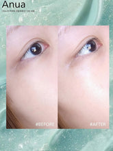 Load image into Gallery viewer, [韩国] Anua PDRN水光套组
