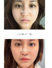 Load image into Gallery viewer, [韩国] Returnity 耳穴贴
