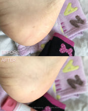 Load image into Gallery viewer, [韩国] Plu 嫩足修护套组
