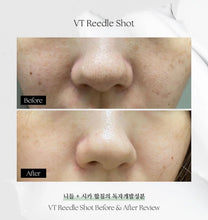 Load image into Gallery viewer, [韩国Daiso] VT 微针精华
