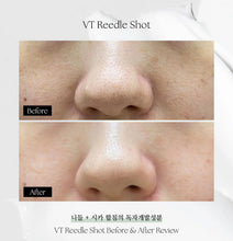 Load image into Gallery viewer, [韩国Daiso] VT 微针精华
