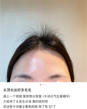 Load image into Gallery viewer, [欧美专柜] Kérastase 卡诗防脱精华
