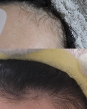 Load image into Gallery viewer, [韩国] LaboH 防脱头皮精华
