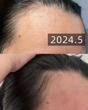 Load image into Gallery viewer, [韩国] LaboH 防脱头皮精华
