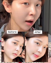 Load image into Gallery viewer, [韩国] YAKSON 瘦脸穴位绷带
