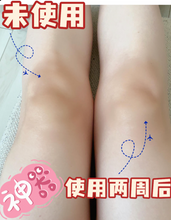 Load image into Gallery viewer, [日本] 小林制药去角质药膏
