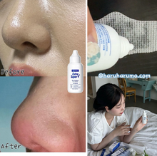 Load image into Gallery viewer, [韩国Daiso] MEDIPEEL 黑头导出液/棉片
