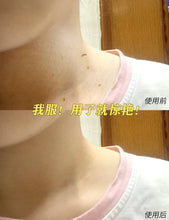Load image into Gallery viewer, [日本] Tsubuparon 去角质粒膏
