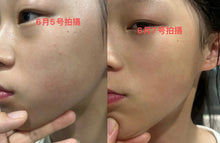 Load image into Gallery viewer, [日本] Takami 小蓝瓶精华
